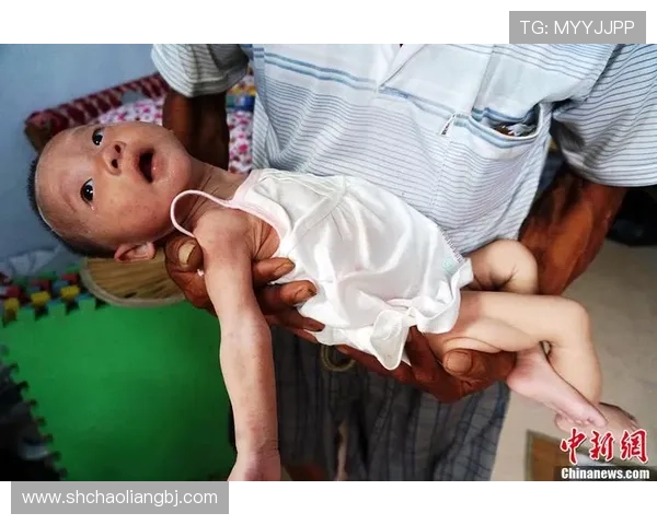 巴黎官方：维蒂尼亚恢复良好 恩贾恩图仍在康复中